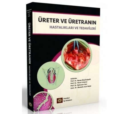 Üreter ve Üretranın Hastalıkları ve Tedavileri